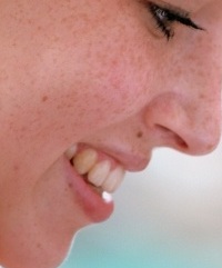 как избавиться от коричневых пятен